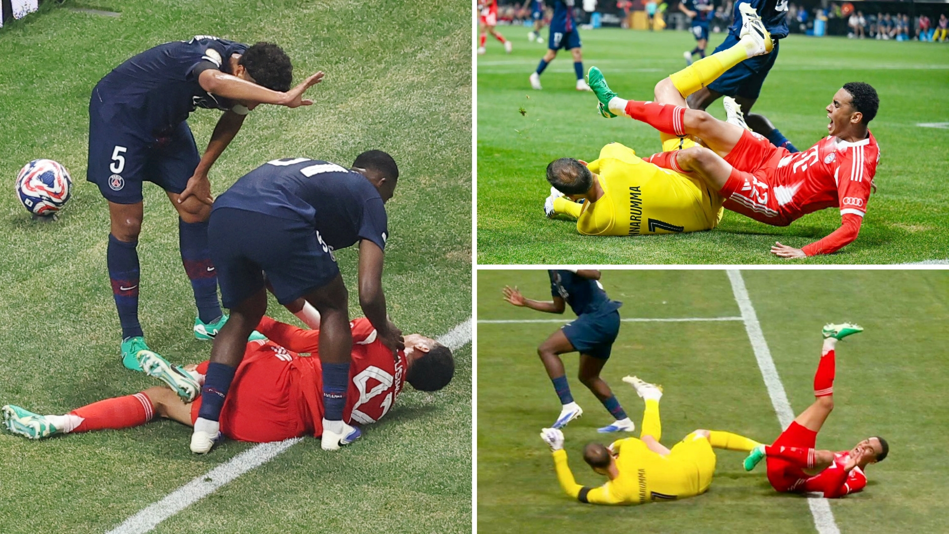 拜仁慕尼黑队员受伤无法参与欧冠联赛 拜仁慕尼黑队员受伤无法参与欧冠联赛